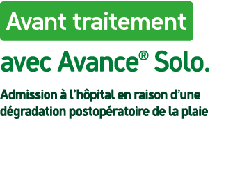 ￼avec Avance® Solo. Admission  l’h pital en raison d’une d gradation postop ratoire de la plaie