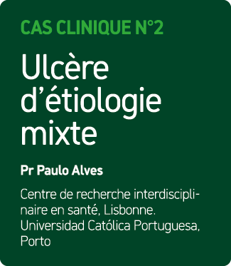 Cas Clinique N°2 Ulc re d’ tiologie mixte Pr Paulo Alves Centre de recherche interdisciplinaire en sant , Lisbonne. U...