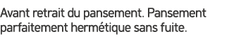 Avant retrait du pansement. Pansement parfaitement herm tique sans fuite.
