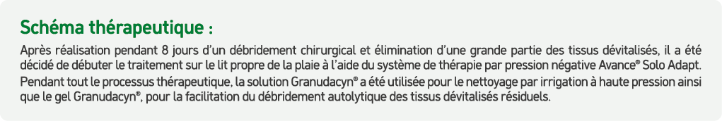 Sch ma th rapeutique : Apr s r alisation pendant 8 jours d’un d bridement chirurgical et limination d’une grande par...
