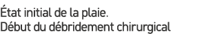  tat initial de la plaie. D but du d bridement chirurgical