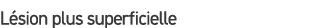 L sion plus superficielle