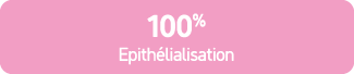 100% Epith lialisation 