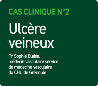 Cas Clinique N°2 Ulc re veineux Pr Sophie Blaise, m decin vasculaire service de m decine vasculaire du CHU de Grenoble