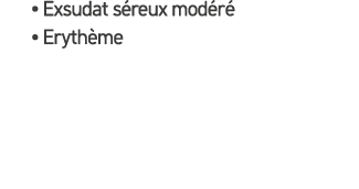 • Exsudat s reux mod r • Eryth me
