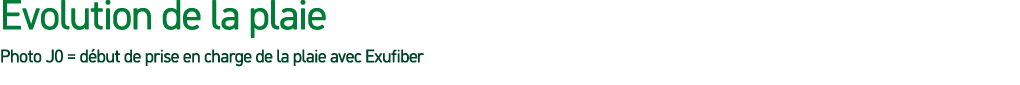 evolution de la plaie Photo J0 = d but de prise en charge de la plaie avec Exufiber