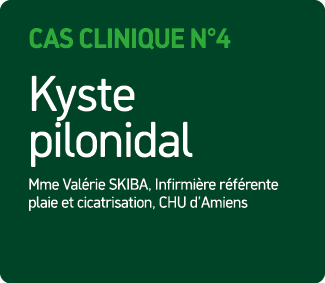 Cas Clinique N°4 Kyste pilonidal Mme Val rie SKIBA, Infirmi re r f rente plaie et cicatrisation, CHU d’Amiens