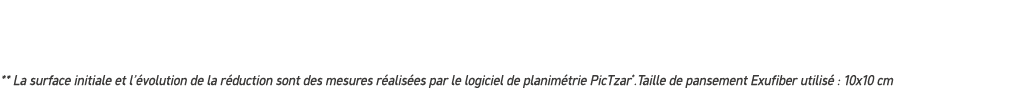 ** La surface initiale et l’ volution de la r duction sont des mesures r alis es par le logiciel de planim trie PicTz...
