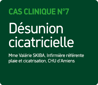 Cas Clinique N°7 D sunion cicatricielle Mme Val rie SKIBA, Infirmi re r f rente plaie et cicatrisation, CHU d’Amiens