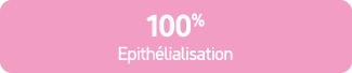 100% Epith lialisation 
