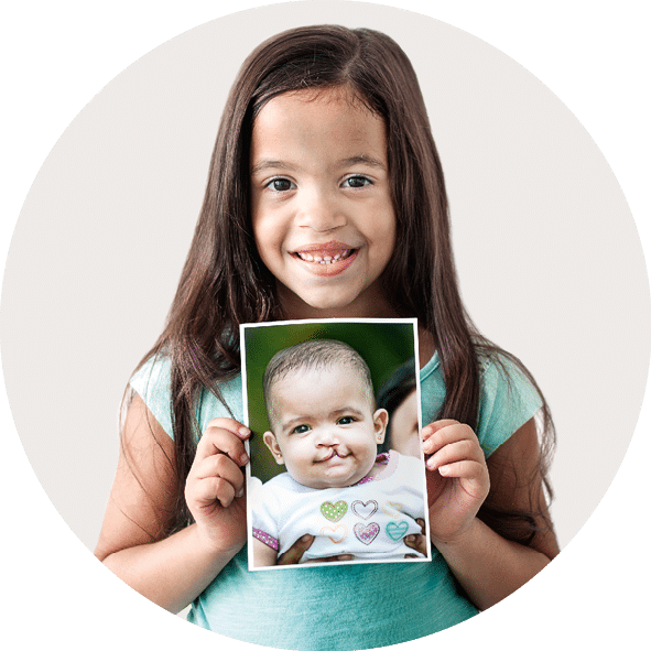 DOM_2015_063_Naiara Bastardo_After_ 063, Naiara Bastardo Paulino had her surgery on 2010 mission in Santo Domingo  6 months old  Santo Domingo,  Dominican Republic  (Operation Smile Photo - Carlos Rueda)